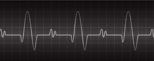 Heart rate variability (HRV)